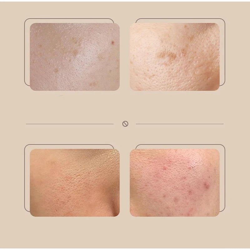 A lightweight Korean rice cream with SPF50+ that hydrates, brightens, and evens your skin tone while delivering a fresh, natural-looking finish that lasts all day.