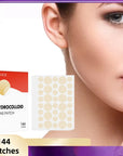 144 Hydrocolloid Acne Patches Round Stickers for Zits  Blemish Care