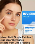 180/360 Hydrocolloid Acne Patches Invisible, Gentle, Alcohol Fragrance Free for Clear, Smooth Skin