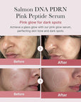 Medicube PDRN Serum Lifting Firming Advanced Skin Repair