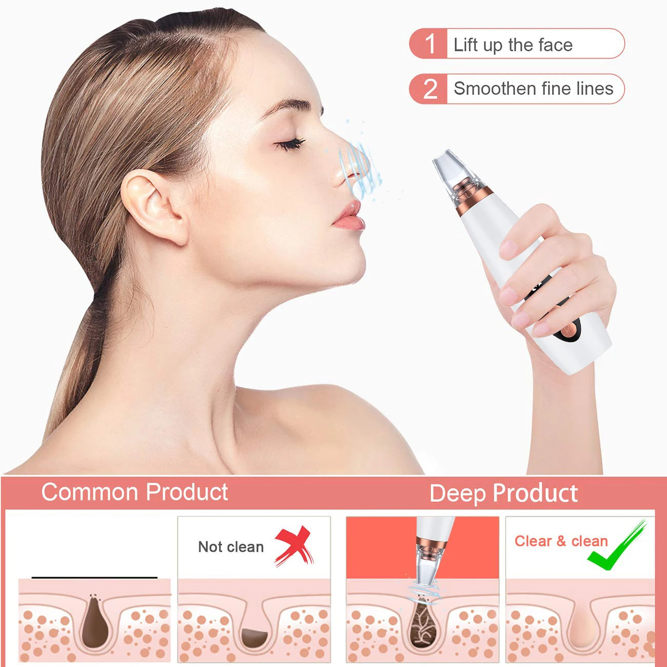 Electric Vacuum Suction Blackhead Remover