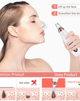 Electric Vacuum Suction Blackhead Remover