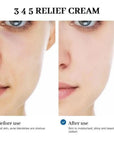 Dr.Althea 147 Relief Cream Deep Hydration, Instant Soothing Skin Repair